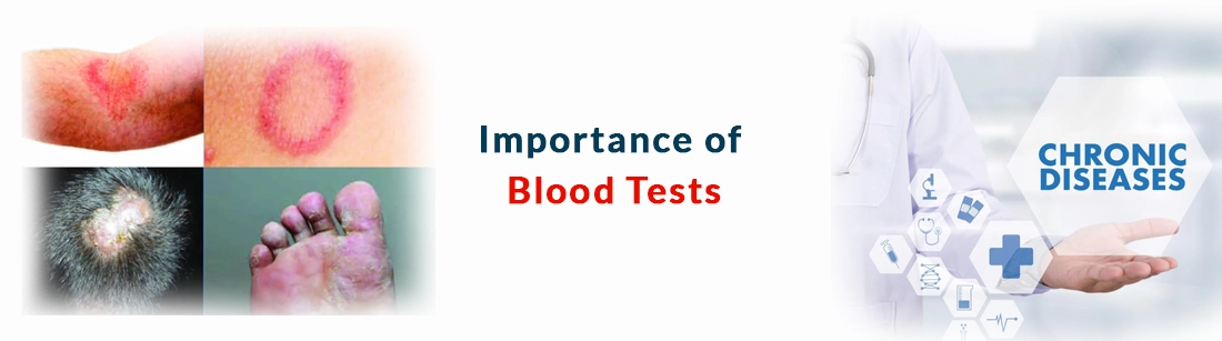Importance of Blood Tests